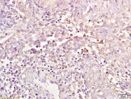 bs-6959R - Estrogen receptor beta