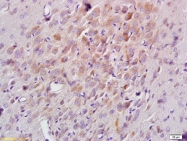 bs-6966R - NCF1