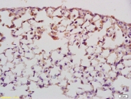 bs-6973R - Myocardin-Like Protein 1