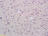 bs-6973R - Myocardin-Like Protein 1