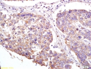 bs-7017R - XAGE2 / G antigen family D member 3