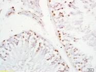 bs-7017R - XAGE2 / G antigen family D member 3