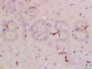 bs-7034R - EPHA7