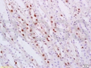bs-7581R - ZHX2