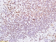 bs-7839R - CENP-F