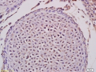 bs-7974R - Ataxin-2