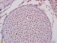 bs-7974R - Ataxin-2