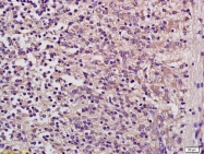 bs-7980R - Beta-glucuronidase