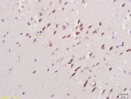 bs-8294R - DPP9 / DPRP2