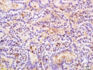 bs-8509R - REG3A
