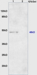 bs-8525R - DNA polymerase beta