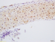 bs-8557R - DSPP
