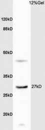 bs-8573R - DHRS2