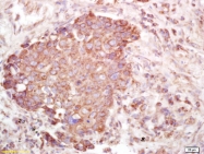 bs-9465R - Vang-like protein 2 (VANGL2)