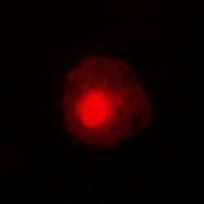 CPA1004-100ul - ABL1/2
