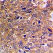 CPA1004-100ul - ABL1/2