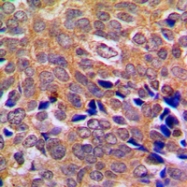 CPA1005-100ul - ABL1/2
