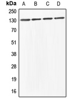CPA1005-100ul - ABL1/2