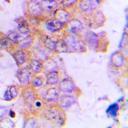 CPA1006-100ul - ACAT1 / MAT
