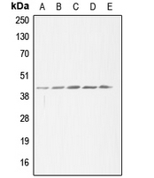CPA1006-100ul - ACAT1 / MAT