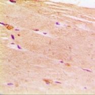 CPA1012-100ul - ACTN2