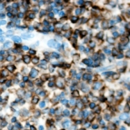 CPA1014-100ul - Activin receptor type 1B / ACVR1B