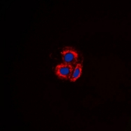 CPA1015-100ul - ACVRL1 / ALK1