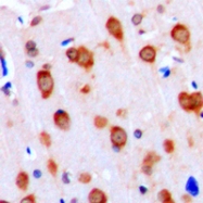 CPA1015-100ul - ACVRL1 / ALK1