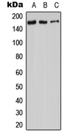 CPA1020-100ul - Adenylate cyclase type 9