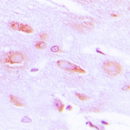 CPA1028-100ul - Beta-ARK-1 / ADRBK1