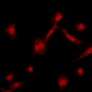 CPA1029-100ul - Beta-ARK-1 / ADRBK1