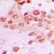 CPA1029-100ul - Beta-ARK-1 / ADRBK1