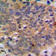 CPA1031-100ul - AKT