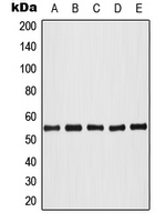 CPA1032-100ul - AKT