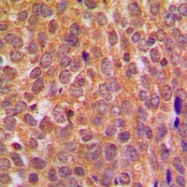CPA1034-100ul - AKT