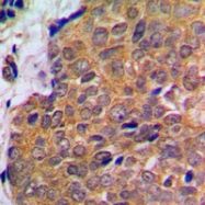 CPA1035-100ul - AKT