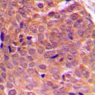 CPA1036-100ul - AKT