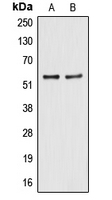CPA1040-100ul - ALDH2