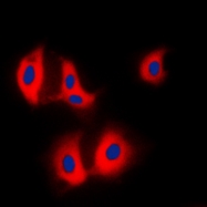 CPA1044-100ul - Aldolase A / ALDOA