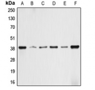 CPA1044-100ul - Aldolase A / ALDOA