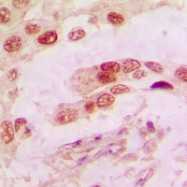 CPA1049-100ul - Annexin A1 / ANXA1