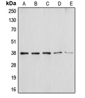 CPA1049-100ul - Annexin A1 / ANXA1