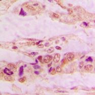 CPA1051-100ul - Annexin A3 / ANXA3