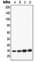 CPA1062-100ul - Apolipoprotein A I / APO AI