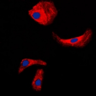 CPA1066-100ul - Kallikrein-3 / PSA / KLK3