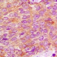 CPA1066-100ul - Kallikrein-3 / PSA / KLK3