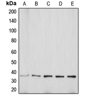 CPA1070-100ul - Aquaporin-5 / AQP5