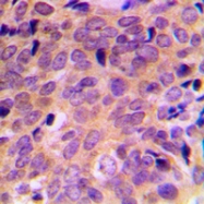 CPA1082-100ul - ATF4