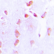 CPA1094-100ul - Bcl-2