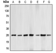 CPA1094-100ul - Bcl-2
